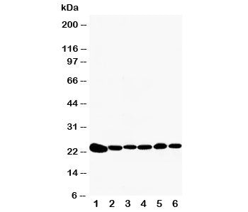 Peroxiredoxin 2 Antibody (PRDX2)