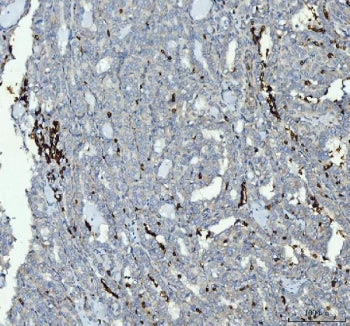 Integrin beta 3 Antibody
