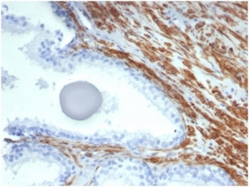 IHC staining of FFPE human prostate tissue with recombinant SMMHC antibody MYH11/7087R). HIER: boil 