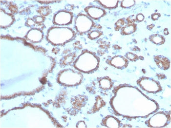 IHC staining of FFPE human thyroid with DBC2 antibody. HIER: boil tissue sections in pH 9 10mM Tris 