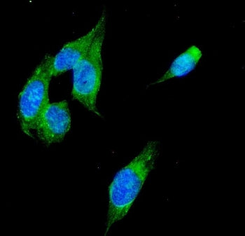 Immunofluorescent staining of FFPE human U-2 OS cells with Alcohol dehydrogenase antibody (green) an