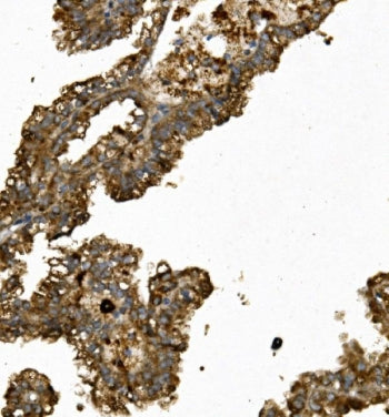 Renin Antibody / REN