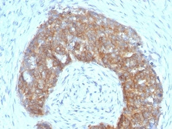 Estrogen Inducible Protein pS2 / TFF1 Antibody