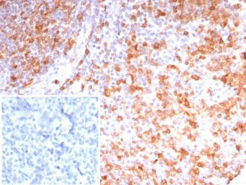 IHC staining of FFPE human tonsil tissue with Stathmin 1 antibody (clone STMN1/8023R). Inset: PBS us