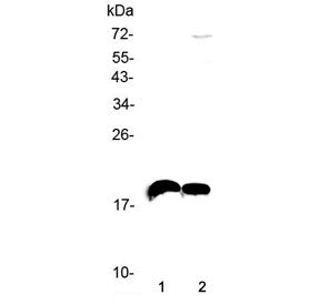 Western blot testing of mouse kidney and 2) mouse brain lysate with Il-22 antibody at 0.5ug/ml. Obse