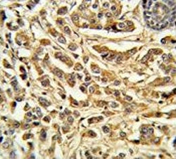 CYP21A2 Antibody / Steroid 21-hydroxylase