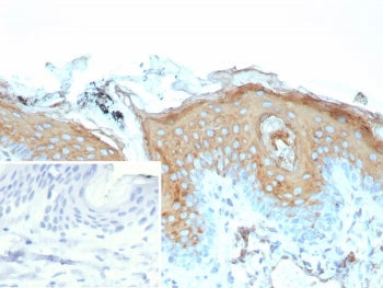 Involucrin Antibody