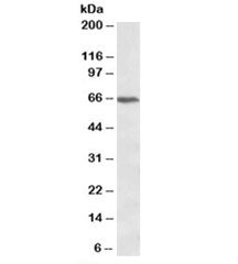 CACNB2 Antibody