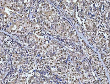CHD8 Antibody / Chromodomain-helicase-DNA-binding protein 8
