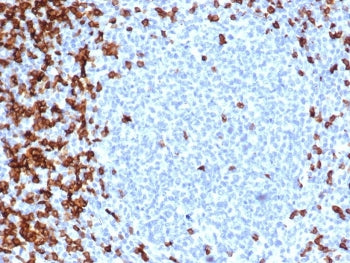 IHC staining of FFPE human tonsil tissue with recombinant CD7 antibody (clone CD7/6388R). HIER: boil
