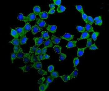 Immunofluorescent staining of FFPE human MCF7 cells with ATP5H antibody (green) and DAPI nuclear sta