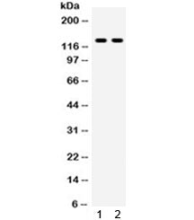 Western blot testing of 1) rat liver and 2) HepG2 lysate with TLR8 antibody. Expected/observed molec