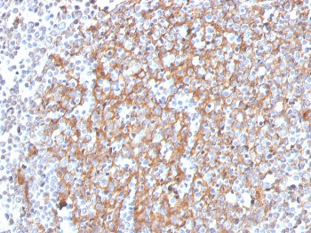 IHC staining of FFPE human prostate with Cystatin A antibody (clone CSTA/3553). HIER: boil tissue se