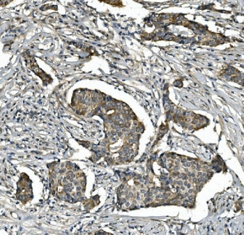 STAT6 Antibody