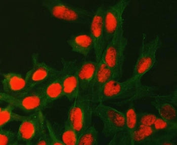 Immunofluorescent staining of FFPE human U-2 OS cells with APG4C antibody (red) and Alpha Tubulin mA