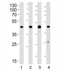 Western blot analysis of lysate from 1) human A549, 2) mouse Neuro-2a, 3) mouse NIH3T3, and 4) rat C