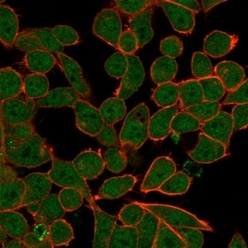 Immunofluorescent staining of PFA-fixed human HeLa cells using ZNF81 antibody (green, clone PCRP-ZNF