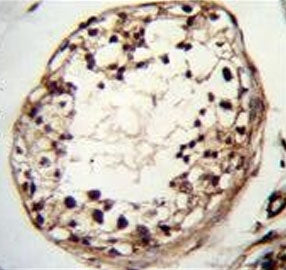 TSPYL6 Antibody