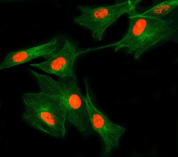Immunofluorescent staining of FFPE human U-87 MG cells with SNRNP27 antibody (red) and Beta Tubulin 