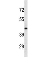 LHX2 Antibody