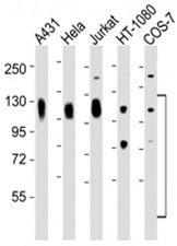 Western blot testing of LAMP antibody at 1:2000 dilution. Lane 1: A431; 2: HeLa; 3: Jurkat; 4: HT-10