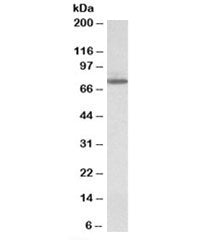 Western blot testing of HeLa lysate with Transglutaminase 4 antibody at 1ug/ml. Predicted molecular 