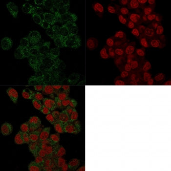 Prohibitin Antibody / PHB