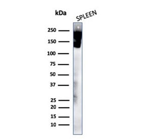Western blot testing of human spleen lysate with recombinant CD45R antibody (clone rPTPRC/1460). Exp