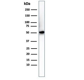 Western blot testing of His-tagged protein with Histidine antibody.