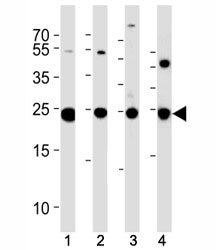 PGP 9.5 Antibody