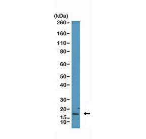 CDKN2A Antibody / p16INK4a