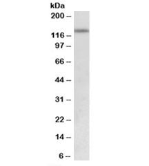 Western blot testing of human uterus lysate with KDM2A antibody at 0.5ug/ml. Predicted molecular wei