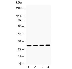 Western blot testing of 1) rat brain, 2) mouse ovary, 3) human 22RV1 and 4) human HeLa lysate with H