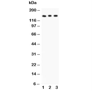 Western blot testing of Insulin Receptor antibody and Lane 1: rat kidney; 2: PANC; 3: HeLa lysate. E