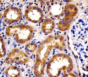 SPHK1 Antibody