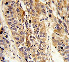 Leucine-rich alpha-2-glycoprotein Antibody / LRG1