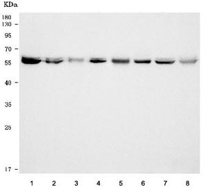 Western blot testing of 1) human HeLa, 2) human U-2 OS, 3) human SW620, 4) human MCF7, 5) rat brain,