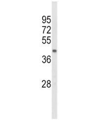Western blot analysis of ACADL antibody and mouse kidney tissue lysate. Predicted molecular weight ~