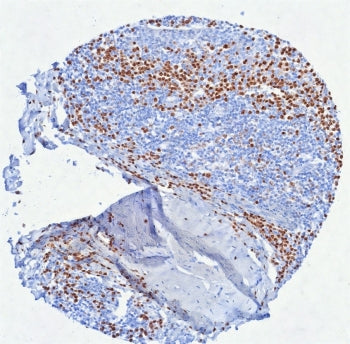 IHC staining of FFPE human tonsil tissue with Interferon regulatory factor 4 antibody (clone MUM1/85