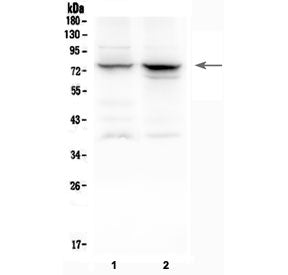 Western blot testing of 1) rat spleen and 2) mouse spleen lysate with 12 Lipoxygenase antibody at 0.