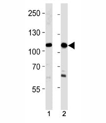 SALL4 antibody western blot analysis in 293,HeLa lysate. Isoform A molecular weight: 112~165 kDa, Is