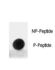 Phospho-MDM2 Antibody (pS395)
