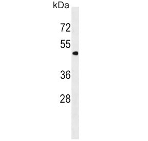 Western blot testing of human K562 cell lysate with PNPLA3 antibody. Predicted molecular weight ~53 