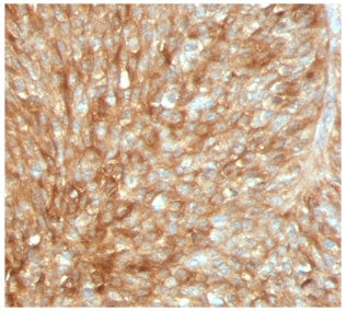 Beta-2 Microglobulin Antibody