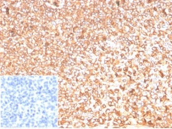 IHC staining of FFPE human tonsil tissue with Actin Beta antibody (clone ACTB/1109). Negative contro