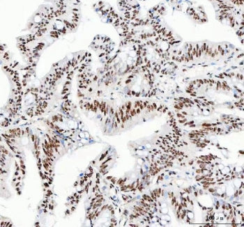 NUCKS1 Antibody / Nuclear ubiquitous casein and cyclin-dependent kinase substrate 1