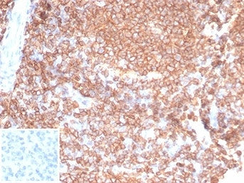 IHC staining of FFPE human tonsil tissue with recombinant CD45RA antibody (clone PTPRC/7019R). Negat