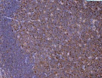 IHC staining of FFPE human tonsil tissue with Eg5 antibody. HIER: boil tissue sections in pH8 EDTA f