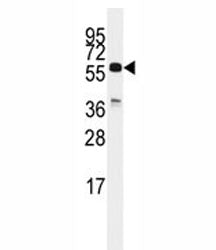 CDC25C Antibody