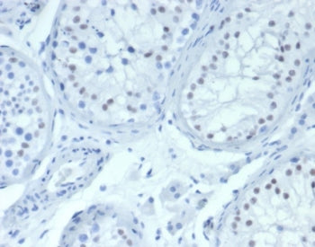 WT1 Antibody / Wilms Tumor 1